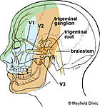 pain in throat-pe-trigeminal_fig1-jpg