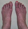 RSD Photos and Pictures Thread-feet-10-20-minutes-jpg