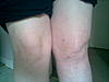 RSD Photos and Pictures Thread-knees4-jpg