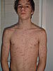 Pic of Josh's pox... I lost count-picture-042-jpg