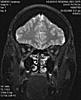 Copies of my newest MRI...-img-1-t1-sag-pre-jpg