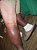 RSD Photos and Pictures Thread-compare-legs-jpg