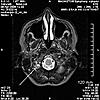 Please Help!  MRI Images..What is that?-b2-jpg