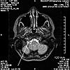 Please Help!  MRI Images..What is that?-c2-jpg
