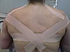 KINESIO TAPINGS (Part 1) (says 5 is max)-dsc01580-jpg