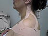 KINESIO TAPINGS (Part 1) (says 5 is max)-dsc01582-jpg