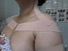 KINESIO TAPINGS (Part 1) (says 5 is max)-dsc01583-jpg