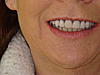 Pics of my new teeth to share, b4 and after-dsc07289-jpg
