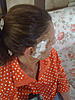 Stimulation... PENS / SCS  for face pain, AD , T.N.-img_1148-jpg