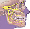 Stimulation... PENS / SCS  for face pain, AD , T.N.-v2-worst-pain-jpg