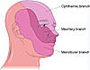 Stimulation... PENS / SCS  for face pain, AD , T.N.-trigeminal-nerve-5-jpg