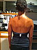 winged scapula and a host of other problems-img_2276-jpg