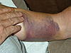 RSD arm is acting odd-jeff-001-jpg