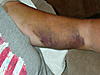 RSD arm is acting odd-jeff-002-jpg