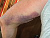 RSD arm is acting odd-jeff-003-jpg