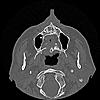 Dental Implants &amp; sinus perforation.-41-jpg