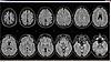 Show me your MRI i'll show you mine-2012-top-jpg