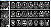 Show me your MRI i'll show you mine-top-dad-middle-kelly-bottom-comp-jpg