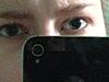 Dilated pupils-photo-4-jpg