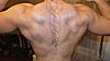 Serratus anterior dysfunction(swimmer's shoulder)-backkl-jpg
