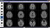 Show me your MRI i'll show you mine-2013-t2-comp-jpg