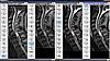 Show me your MRI i'll show you mine-06-09-11-13-spines-comp-jpg