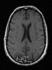 Brain scan query-headexp0034-jpg