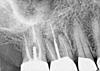 Help me how do I determine which oral surgeon to choose?-image000lsmall-jpg