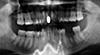 retained root tip-pano_cropped-jpg