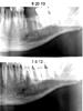 Large tooth abscess spread to jaw (gulp)-2contrast-jpg