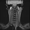 MRI of neck and throat-i0000004-jpg