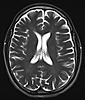 Show me your MRI i'll show you mine-brain-2014-jpg