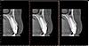 Can't decide what to do with my root canal-ct2-jpg