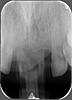 Bryanna how can i be sure dentist has removed perio ligament properly-macmahen_christopher_1979_01_18-2015_03_23_17_33_41-3-jpg