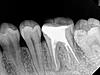 Is there anything wrong with my upper tooth?-r2-jpg