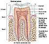 Extraction Site/Neighbouring Tooth Pain Two Weeks after Molar Extraction-dentin-tubules-jpg