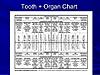 Extracting a tooth that's part of a bridge-tooth-organ-chart-jpg