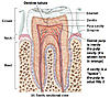Infection under a root canal-dentin-tubules-jpg